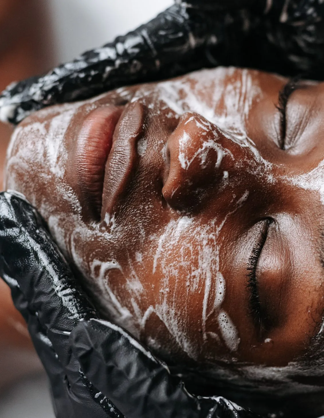 Skin Clarity treatment